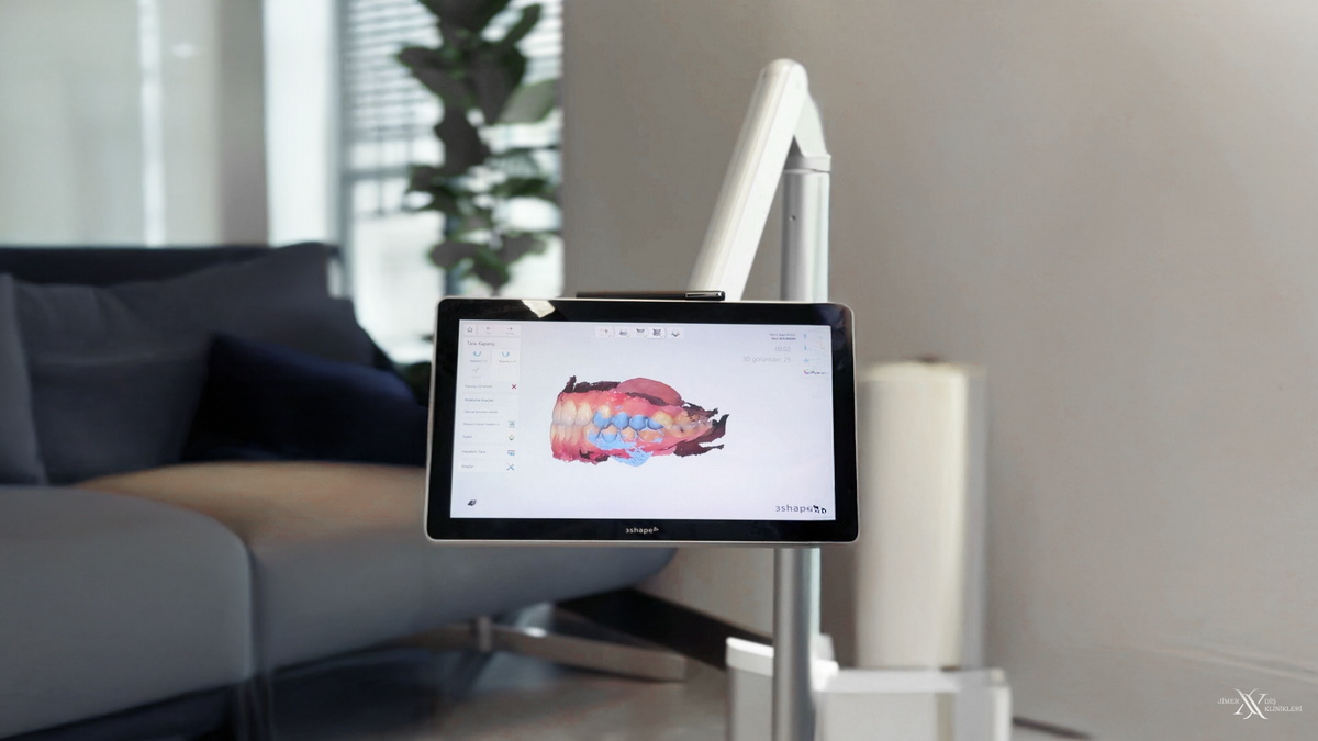 Bursa Digital Smile Design (DSD) und Planung