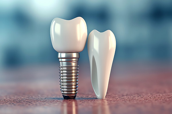 Implantat Implantat
